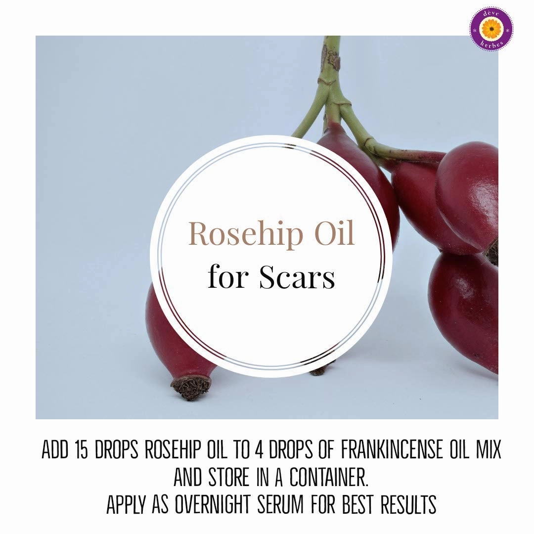 dève herbes Pure Rosehip Oil (Rosa rubiginosa) Cold Pressed 100ml (3.38oz)