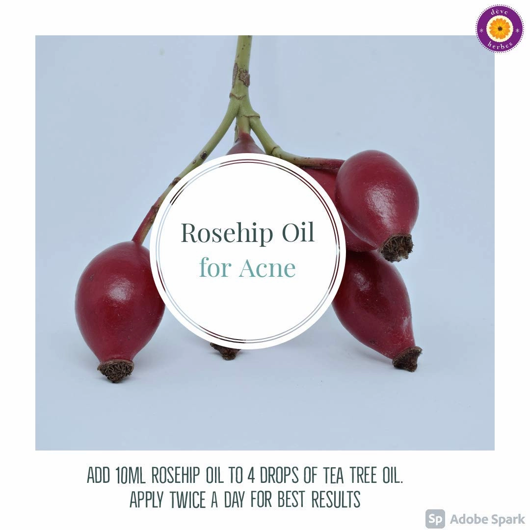 dève herbes Pure Rosehip Oil (Rosa rubiginosa) Cold Pressed 100ml (3.38oz)