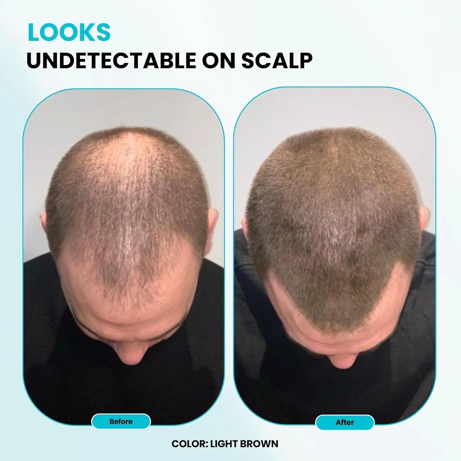 SureThik Hair Thickening Fibers (30g, Grey) - Lightweight Volume Maximizer & Building Hair Fibers for Thinning Hair